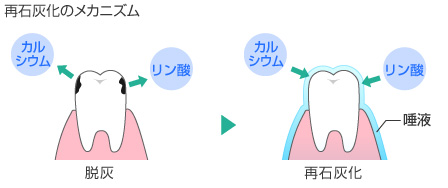 再石灰化のメカニズム 脱灰 再石灰化