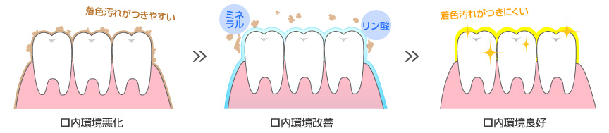 口内環境悪化 着色汚れがつきやすい   口内環境改善  ミネラル リン酸 口内環境良好 着色汚れがつきにくい 